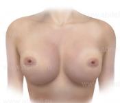 Какие бывают формы женской груди?