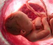 Поздний токсикоз беременных: причины и последствия